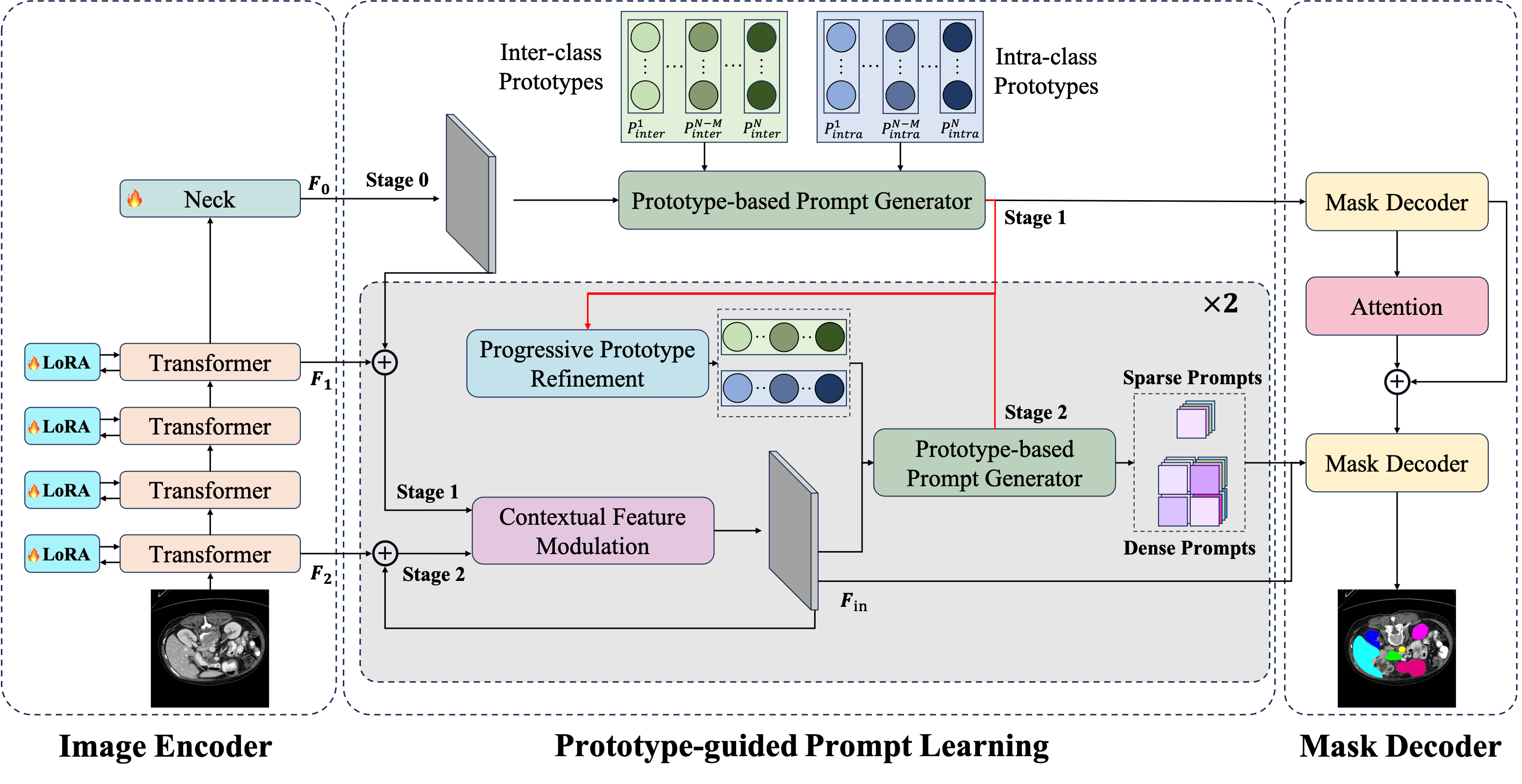 PGP-SAM: Prototype-Guided Prompt Learning for Efficient Few-Shot Medical Image Segmentation